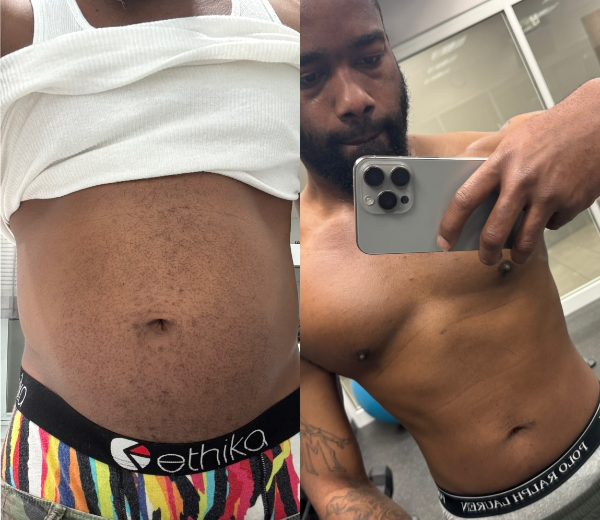 Client transformation